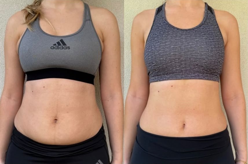 Antes e depois da Rita Caetano