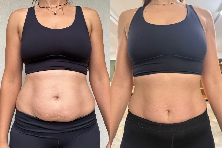 Antes e depois da Mariana Conde